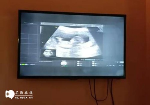 2022产后妈妈脱发太严重，多久能够恢复正常-