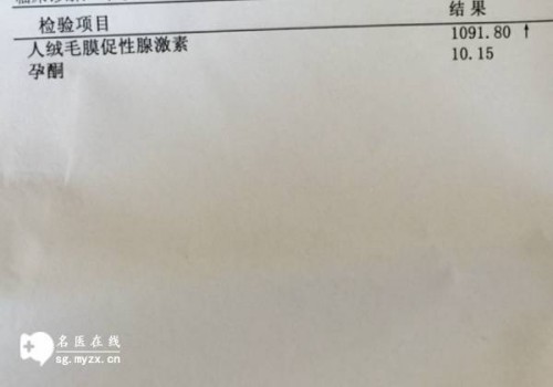 成都三代试管助孕：葡萄籽有助于调节月经周期吗,葡萄籽经期可以吃吗
