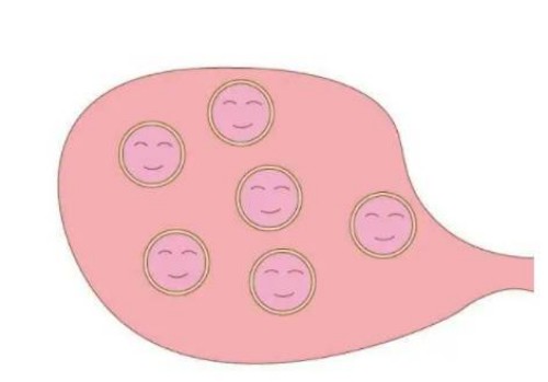 成都助孕机构：试管免疫治疗有用吗,需要进行全面检查