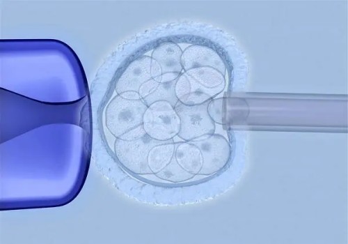 成都试管助孕公司：妇女有必要做两癌筛查吗,根据个人情况而定